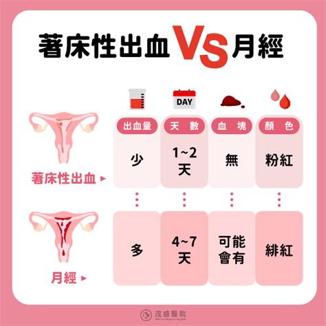 著床位置|著床痛多久？婦產科醫師公開著床時間、容易著床方。